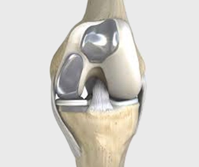 Partial Knee Replacement Chichester West Sussex Mr Michael Moss